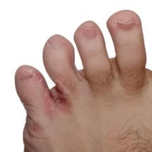 champignon entre les doigts