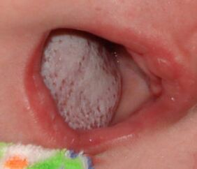 Localisation de la maladie avec un champignon