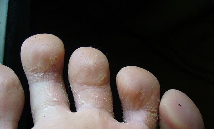 stade initial du champignon